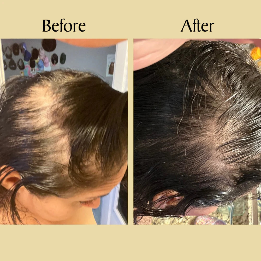 Batana Miracle Hair Oil